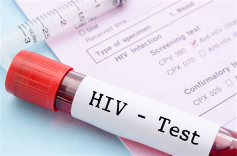 how to protect yourself from catching hiv broadgate