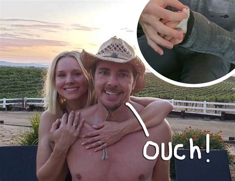 kristen bell says dax shepard crushed all the bones in his hand but