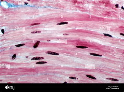 lm du muscle lisse photo stock alamy