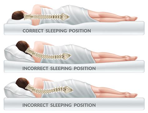 Sleeping Positions For Back And Neck Pain Edison Spine