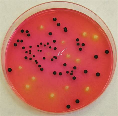 salmonella  xld xld  produce pink  red colonies  black