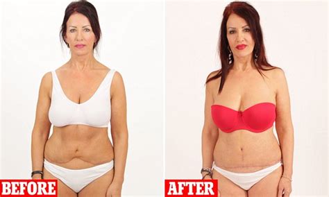 Extreme Beauty Disasters Woman S Stomach A Mess After