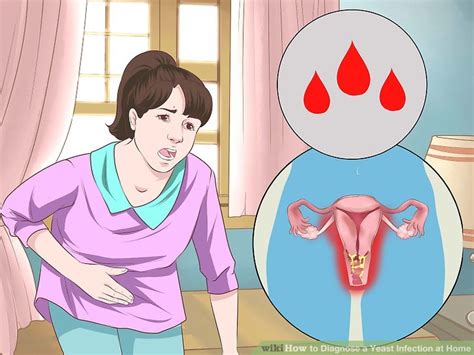 How To Diagnose A Yeast Infection At Home 12 Symptoms
