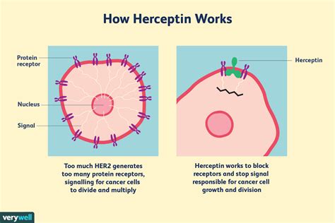 Herceptin Therapy For Breast Cancer