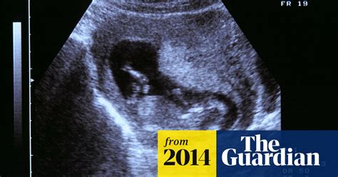 Lets Talk About Miscarriage Pregnancy The Guardian