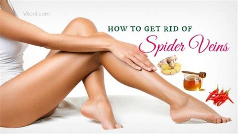 16 Ways On How To Get Rid Of Spider Veins Naturally At Home