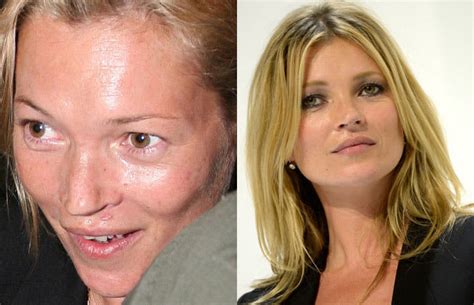 kate moss 30 shocking photos of hot celebrities without makeup or photoshop complex