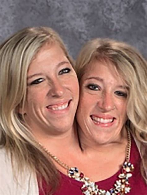 abby and brittany hensel — see what the famous conjoined