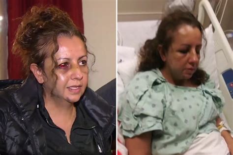 Mom ‘kicked And Stomped On’ By Teen Daughter’s Bully After Going To