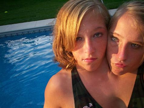 Memorias Perdidas Abby And Brittany Hensel Conjoined Twins