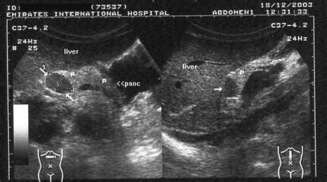 A Gallery Of High Resolution Ultrasound Color Doppler
