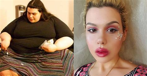 Watch The Amazing Journey Of A 657 Lb Woman Who Lost An