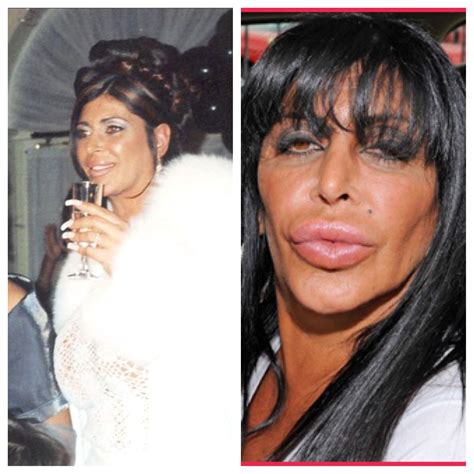 Big Ang ~mob Wives This Lady Trips Me Out Plastic Surgery Bad