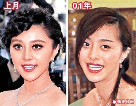 Fan Bingbing Before Plastic Surgery Always Interesting What You Can