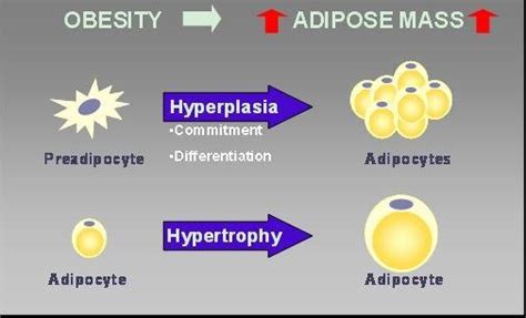 hyperplasia and hypertrophy of adipocytes leads to the increase of