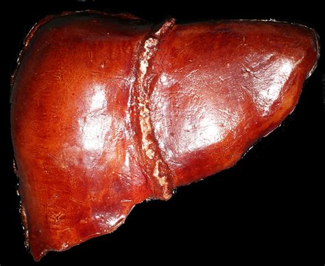 human liver real images