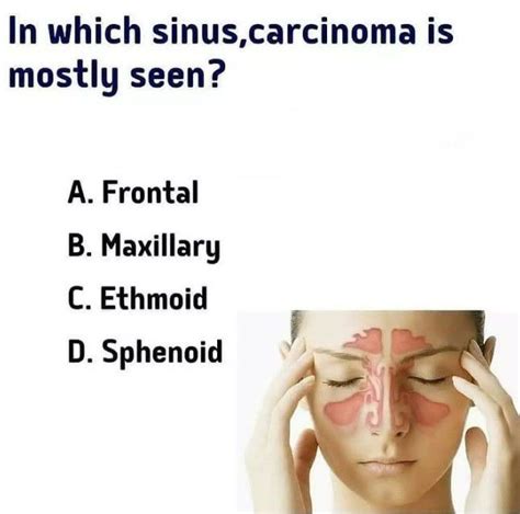sinus carcinoma medizzy
