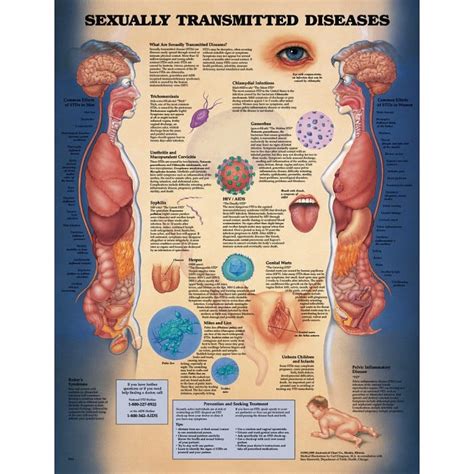 Sexually Transmitted Infections Anatomical Chart Anatomical Models