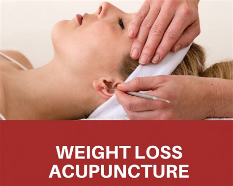 weight loss acupuncture toronto
