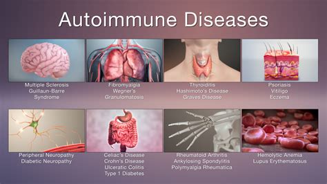 autoimmune diseases symptoms  treatments scientific animations