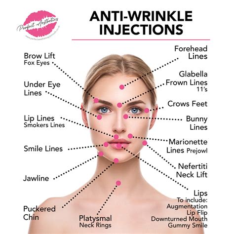 anti wrinkle treatments perfect aesthetics plymouth