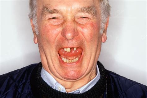 People With Ugly Teeth Peoplesc