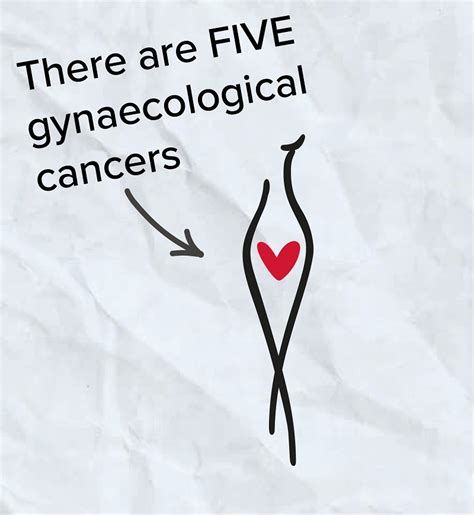 gynae cancers video a brief explanation eve appeal