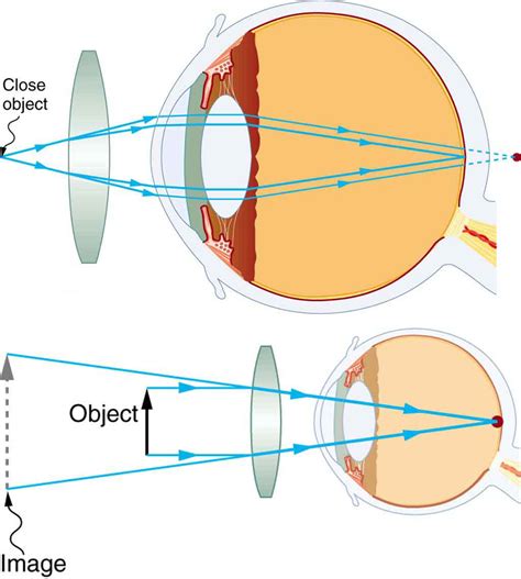vision correction college physics openstax