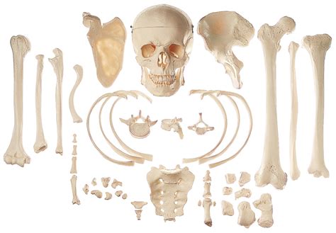 Somso Collection Of Typical Human Bones