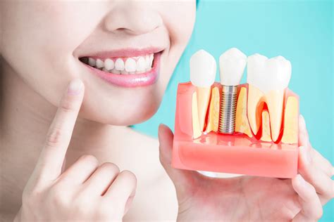 clean dental implants periodontal associates