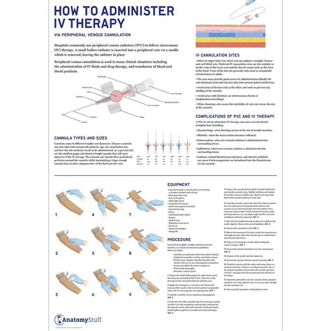 administer iv therapy poster guide  intravenous therapy