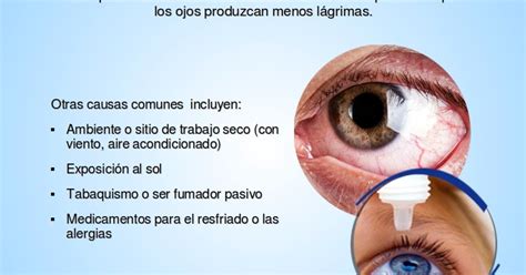 clínica de ojos oftalmic láser sÍndrome de ojo seco