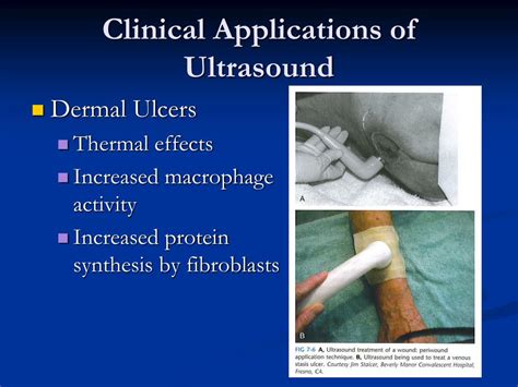 Ppt Ultrasound Powerpoint Presentation Free Download Id 1873680