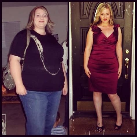19 Best Weight Loss Surgery Before And After Photos Images