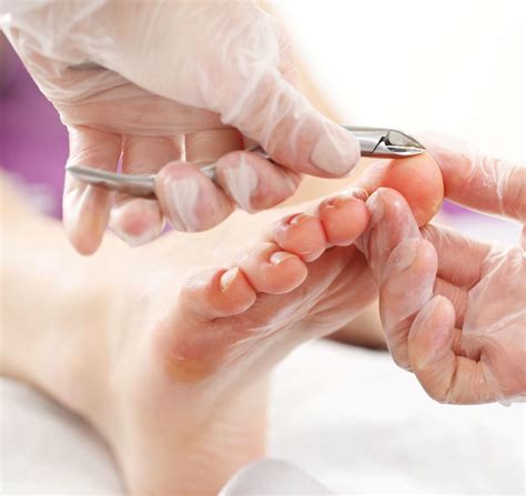 foot care treatments  ottawa natural sole wellness