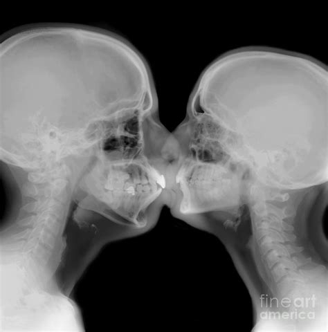 X Ray Of A Couple Kissing Photograph By Guy Viner