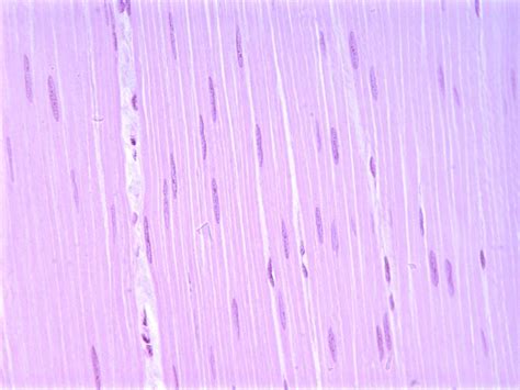 chapter  page  histologyolm  tissue types smooth muscle