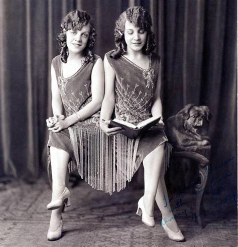 These Conjoined Twins Were Famous In The 1920s But Few Know Their
