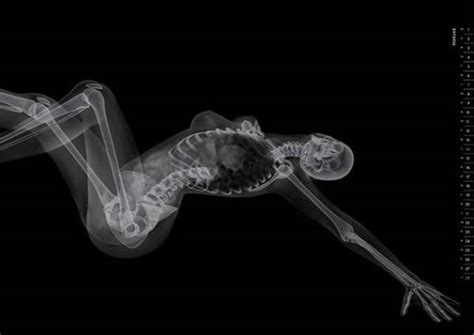 Funny X Ray Images