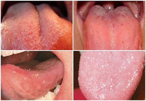 how to make tongue longer acharyajpsingh