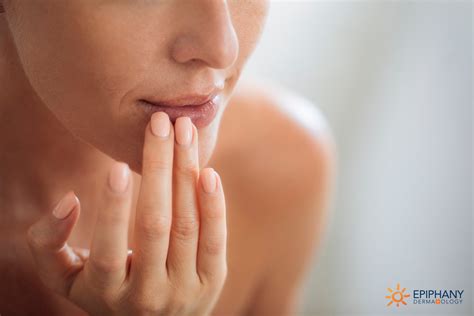 How To Treat Sunburned Lips To Avoid Long Term Skin Damage