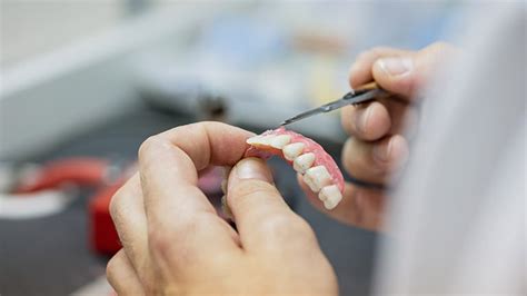 vergoedingen voor tand en mondzorg tandarts cz