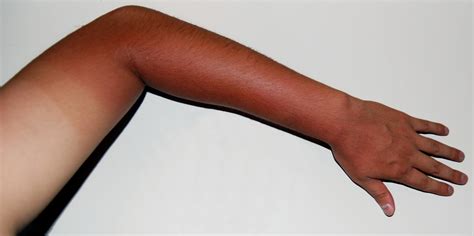 kesehatan hari   memutihkan kulit tangan  kaki secara alami