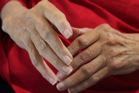 rheumatoid arthritis  triggers  immune response