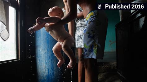 birth defects in brazil may be overreported amid zika fears the new