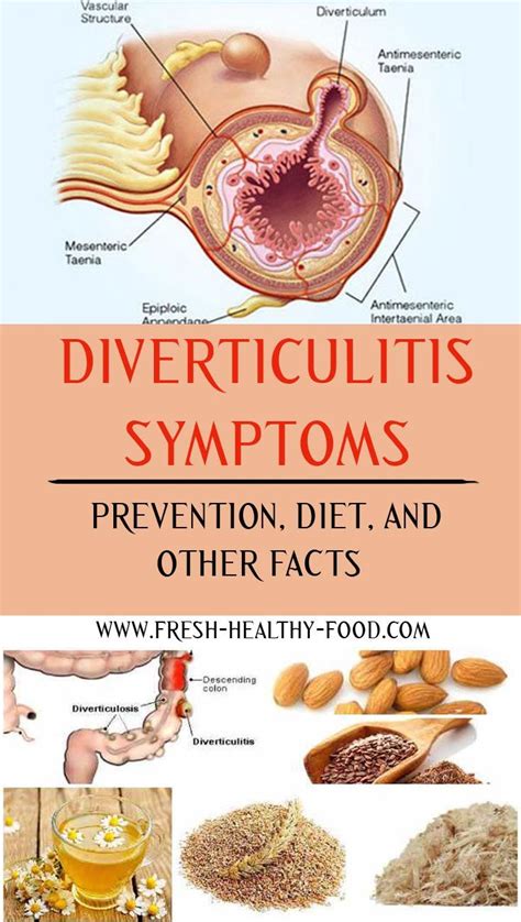 Diverticulitis Symptoms Prevention Diet And Other Facts