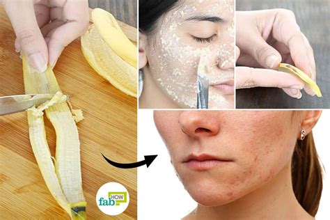 10 Ways To Use Banana Peel For Face Teeth And Skin Fab How