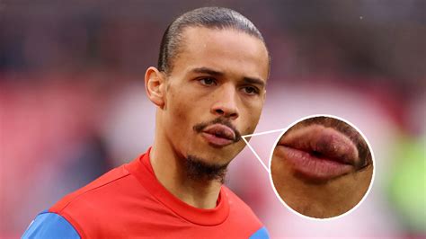 leroy sane shows  busted lip   time   punched  bayern munich team mate