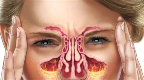 nasal sinuses anatomy faculty  medicine