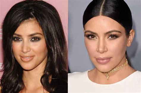 How Real Are The Kardashians—kim—plastic Fantastic Or Au